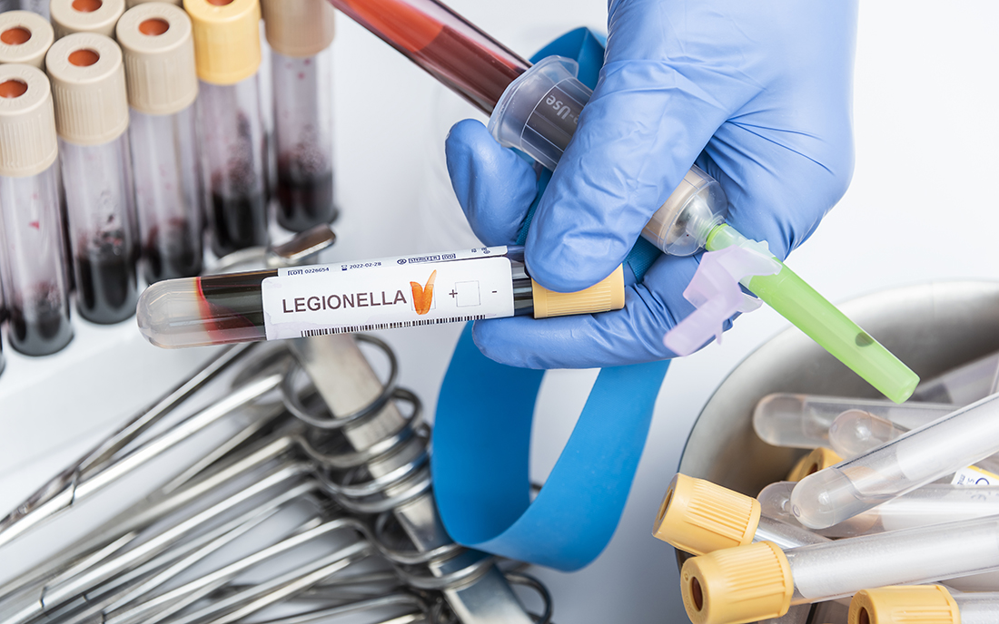 Labor, was Legionellen untersucht